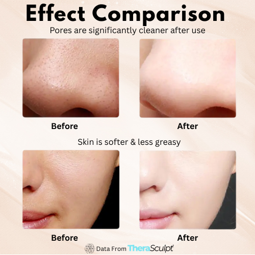 Aurora® Ultrasonic Skin Spatula